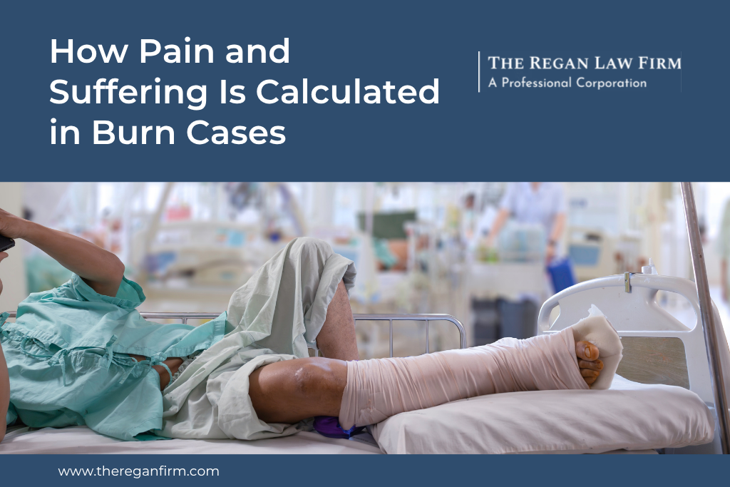 How Pain and Suffering Is Calculated in Burn Cases