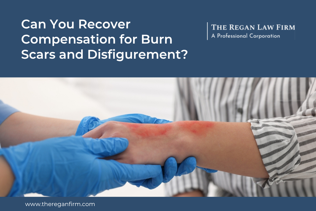Can You Recover Compensation for Burn Scars and Disfigurement?