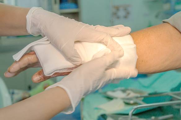 Dressing burned wound hand with gauze pad