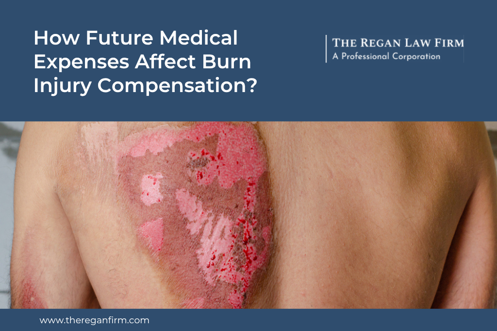 How Future Medical Expenses Affect Burn Injury Compensation?